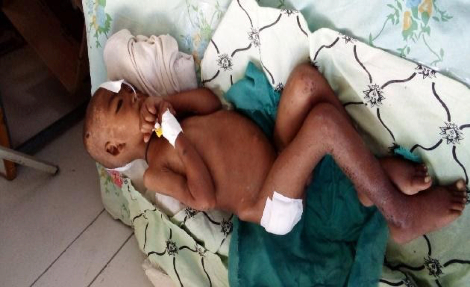 Child from Tigray Rute Kidney disease